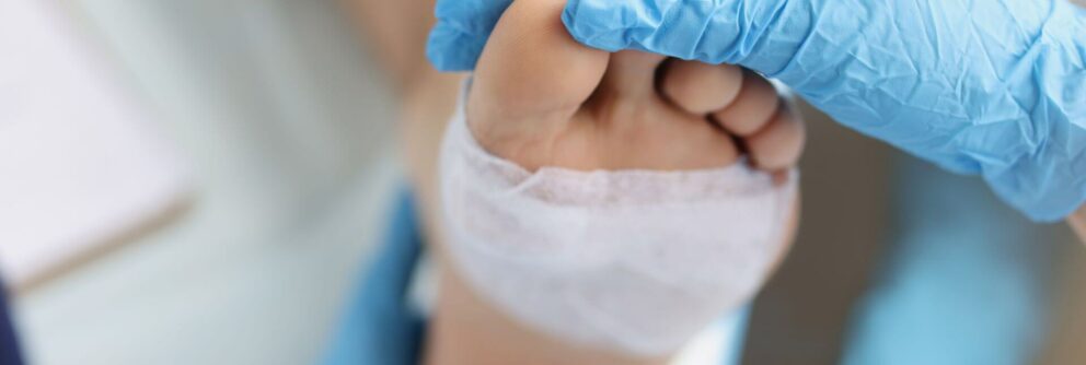 Managing the Complexities of Diabetic Wounds